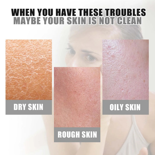 Exfoliating Mousse Face Scrub Shrinking Pores Anti Acne Blackhead Remove Oil Control Smooth Moisturizing Facial Foaming Cleanser