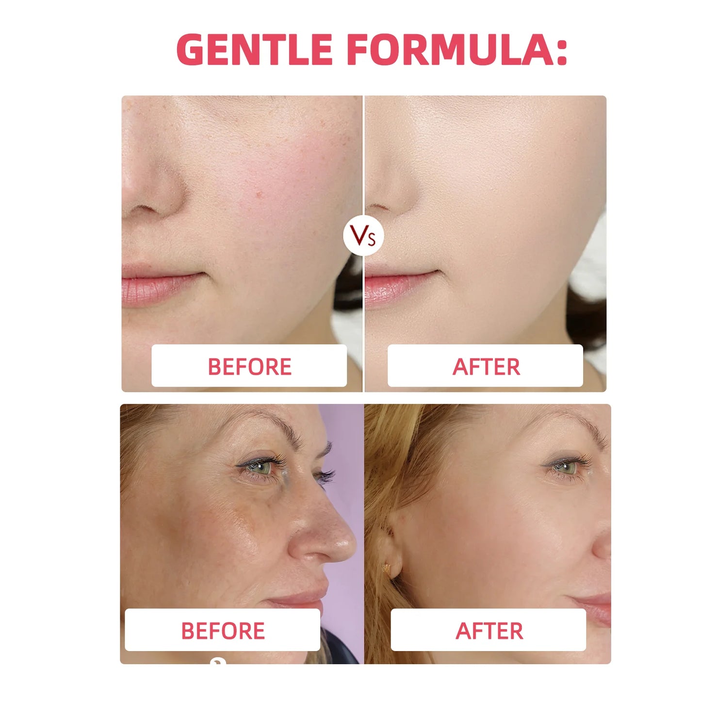 PDRN Collagen Jelly Cream Anti-wrinkle Firms Lifts Accelerate Tissue Repair & Boost Elasticity 7 Collagen Complex + PDRN Synergy