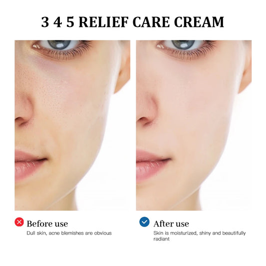 345 Relief Cream solution to skin problems Anti-sugar and antioxidant  Address Blemishes Nourish Long lasting Moisturizer Korean